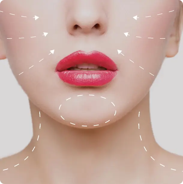 Faltenbehandlung mit Botox und Hyaluron